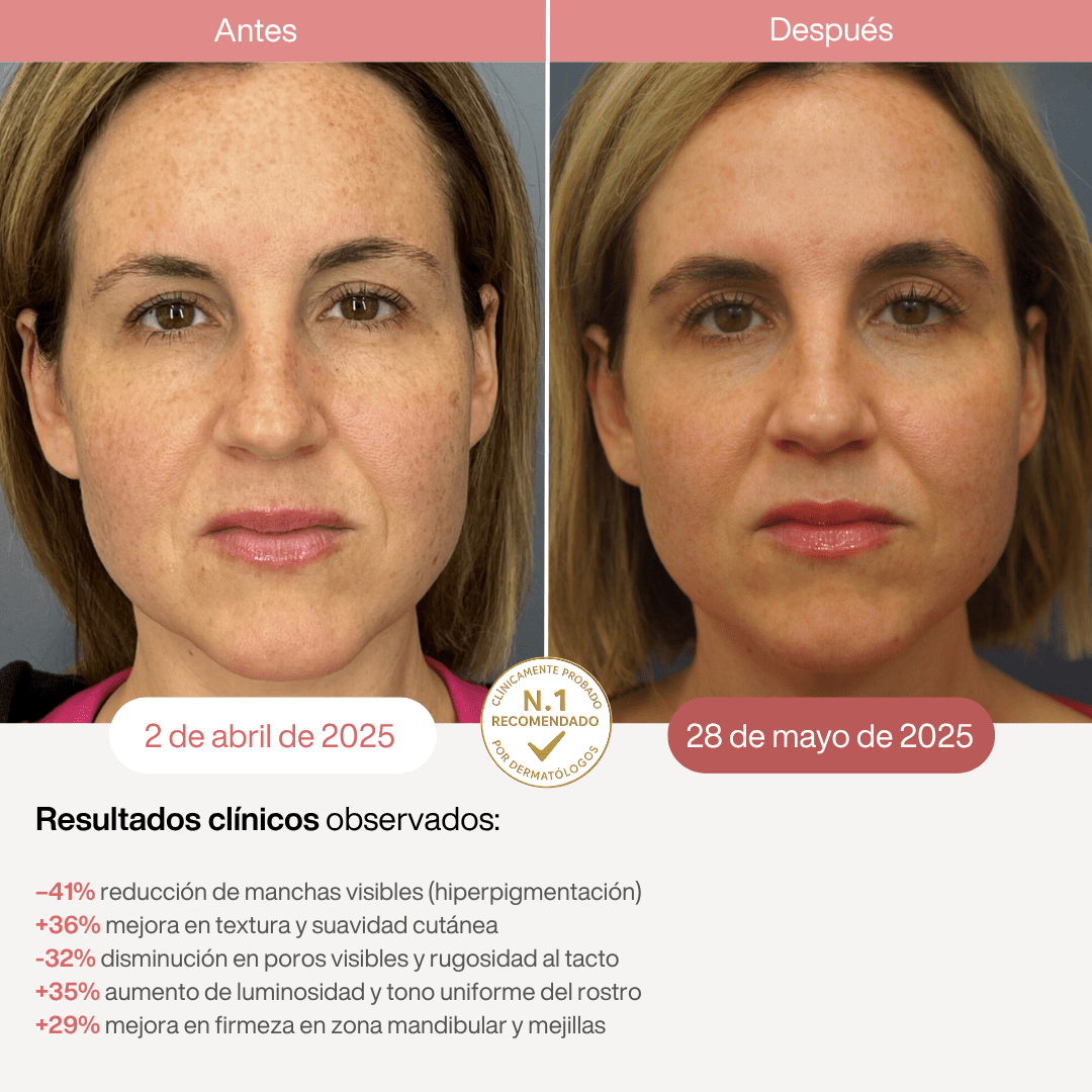 Máscara LED Infrarroja Profesional - 850nm - Montber Professional Brand