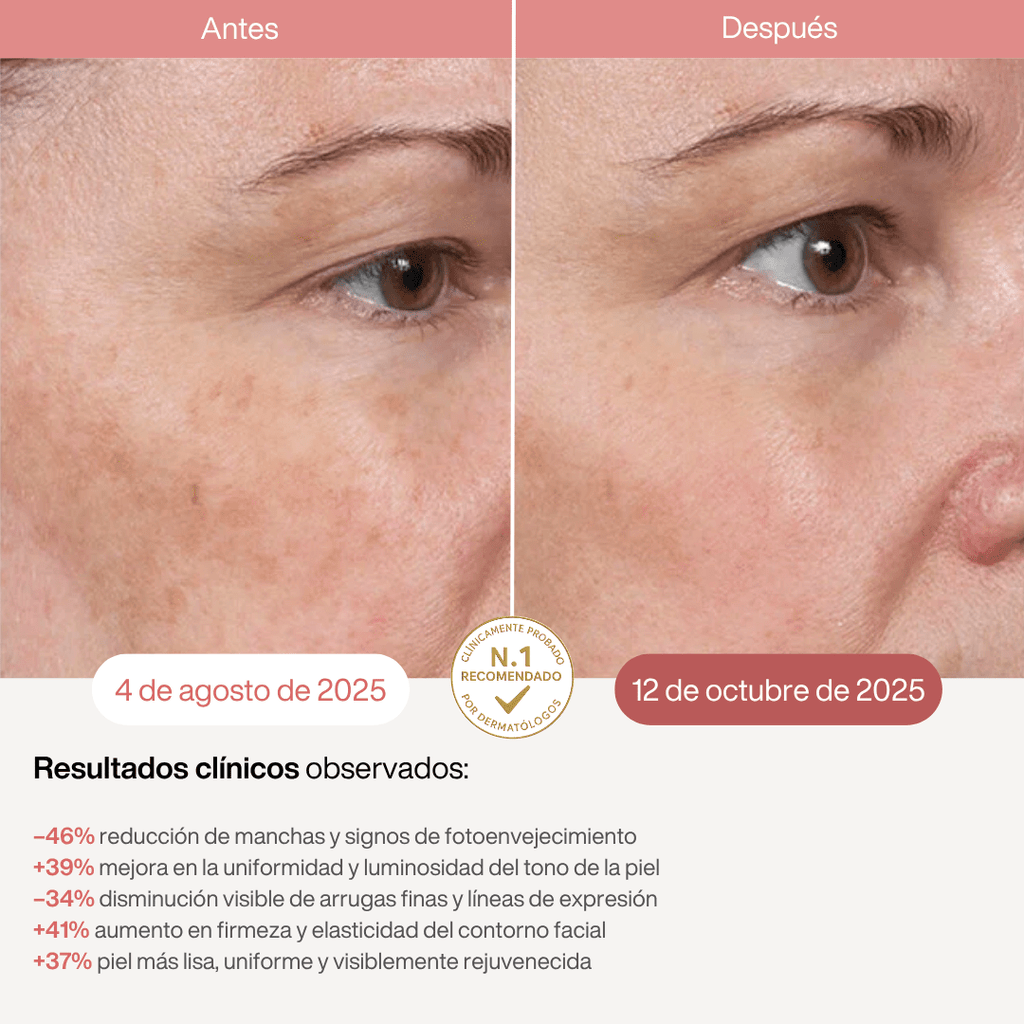 Máscara LED Infrarroja Profesional - 850nm - Montber Professional Brand