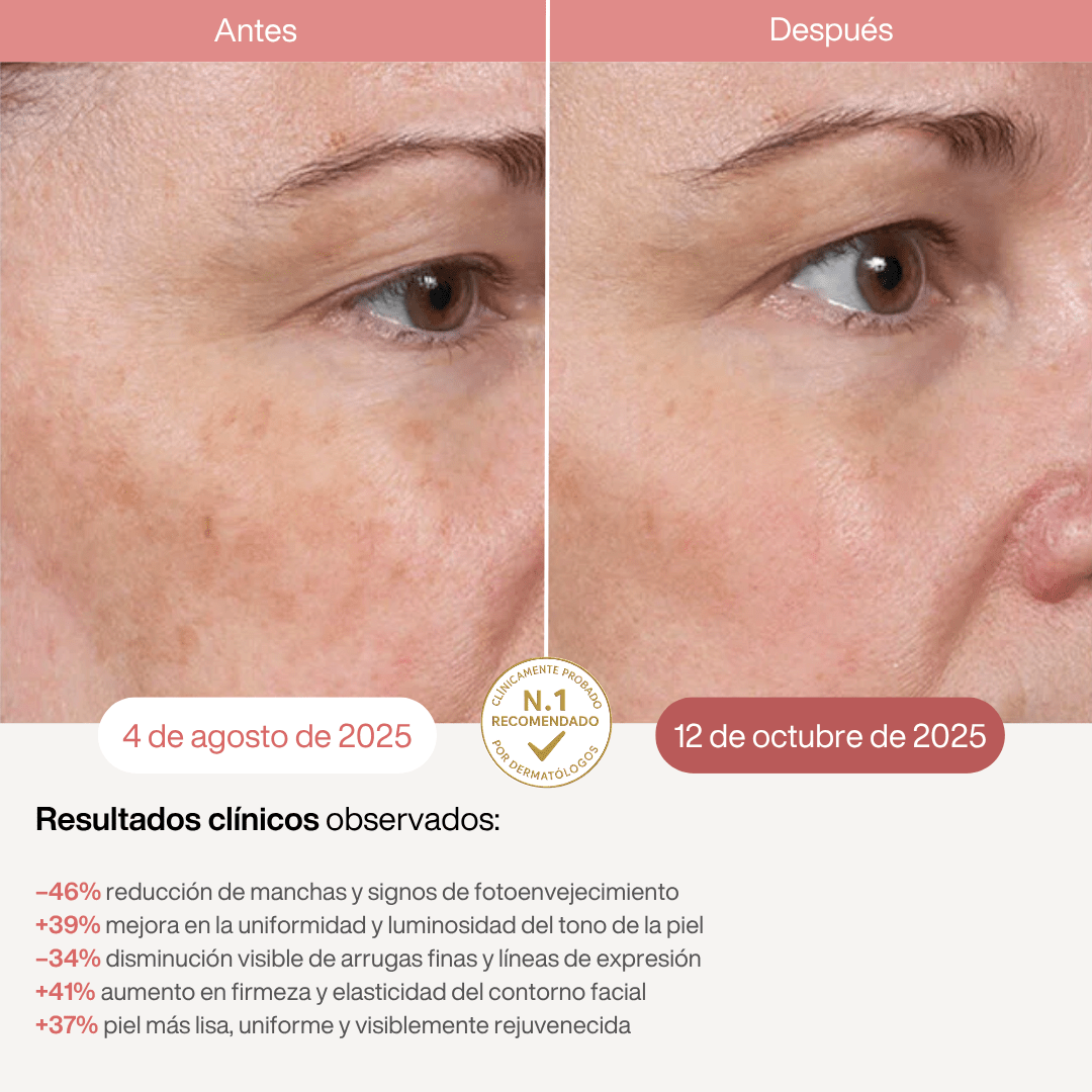 Máscara LED Infrarroja Profesional - 850nm - Montber Professional Brand