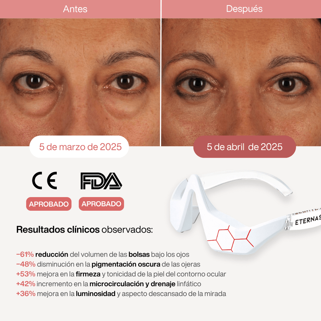 Reparador Bolsas y Ojeras con LED y Microcorriente - Montber Professional Brand