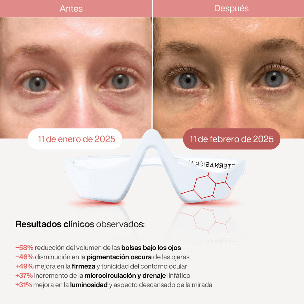 Reparador Bolsas y Ojeras con LED y Microcorriente - Montber Professional Brand