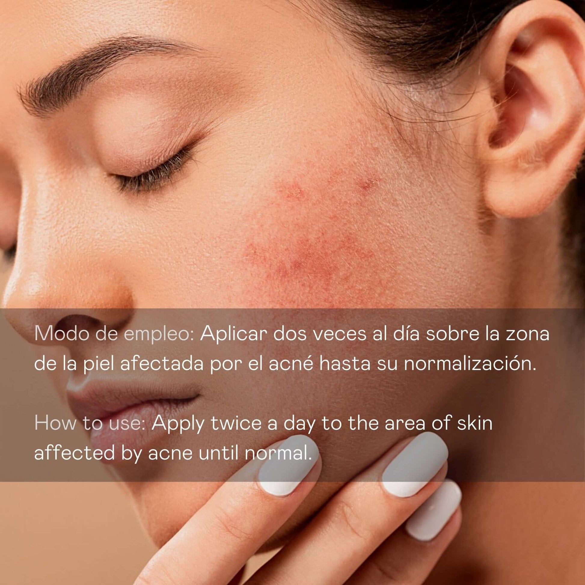 Sérum Facial Antiimperfecciones Directo – Acción Intensiva - 30 ml - Montber Professional Brand
