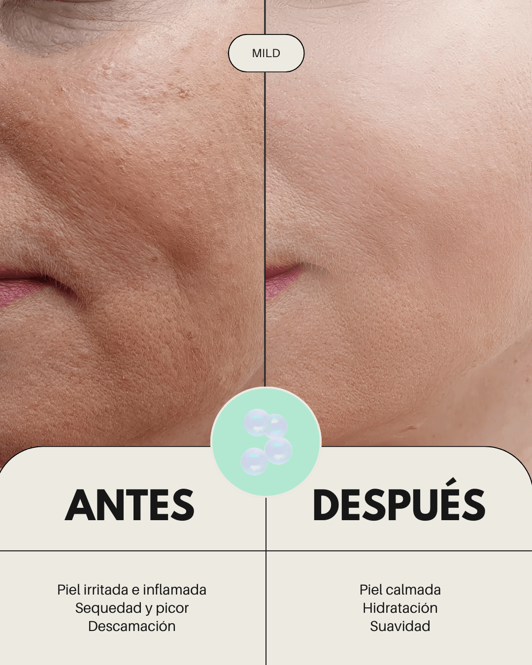 Sérum Facial Calmante Pieles Sensibles con Rojeces MILD - Montber Professional Brand